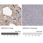 GPATCH11 Antibody in Immunohistochemistry (IHC)