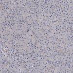 GPATCH11 Antibody in Immunohistochemistry (IHC)