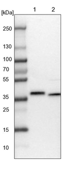 GPATCH11 Antibody in Western Blot (WB)