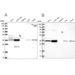 GPATCH11 Antibody in Western Blot (WB)