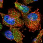 PARM1 Polyclonal Antibody