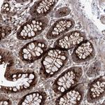 PARM1 Antibody in Immunohistochemistry (IHC)