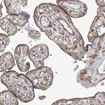 PARM1 Antibody in Immunohistochemistry (IHC)