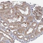 PARM1 Antibody in Immunohistochemistry (IHC)