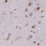 TCOF1 Antibody in Immunohistochemistry (IHC)