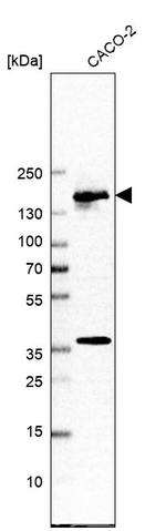 TCOF1 Antibody in Western Blot (WB)