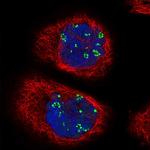 TCOF1 Polyclonal Antibody