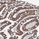 CXorf56 Polyclonal Antibody