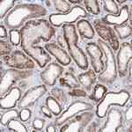 XPO6 Antibody in Immunohistochemistry (Paraffin) (IHC (P))
