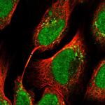 TTC33 Polyclonal Antibody