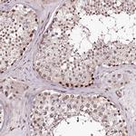 TTC33 Antibody in Immunohistochemistry (IHC)
