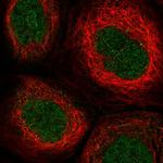 TTC33 Polyclonal Antibody