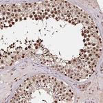 TTC33 Antibody in Immunohistochemistry (IHC)