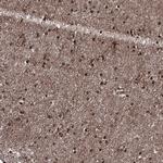 PRPF40A Antibody in Immunohistochemistry (Paraffin) (IHC (P))