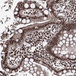 PRPF40A Antibody in Immunohistochemistry (Paraffin) (IHC (P))