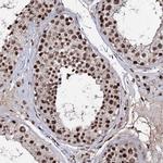 PRPF40A Antibody in Immunohistochemistry (Paraffin) (IHC (P))