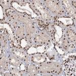 TBC1D12 Antibody in Immunohistochemistry (Paraffin) (IHC (P))