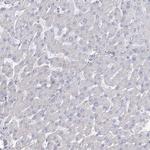 C12orf24 Antibody in Immunohistochemistry (IHC)