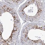 C12orf24 Antibody in Immunohistochemistry (IHC)