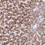 SPINK9 Polyclonal Antibody