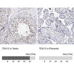 TEX12 Polyclonal Antibody
