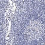 TEX12 Antibody in Immunohistochemistry (IHC)