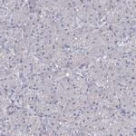 TEX12 Antibody in Immunohistochemistry (IHC)