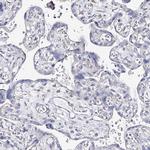 TEX12 Antibody in Immunohistochemistry (IHC)