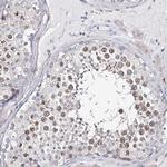 TEX12 Antibody in Immunohistochemistry (IHC)