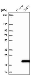 TEX12 Antibody in Western Blot (WB)