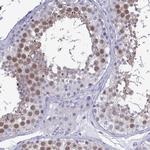 TEX12 Polyclonal Antibody