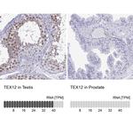 TEX12 Antibody in Immunohistochemistry (IHC)