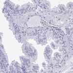 TEX12 Antibody in Immunohistochemistry (IHC)