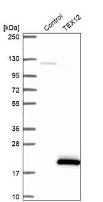 TEX12 Antibody in Western Blot (WB)