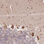 TMIE Antibody in Immunohistochemistry (Paraffin) (IHC (P))