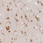 TMIE Antibody in Immunohistochemistry (Paraffin) (IHC (P))