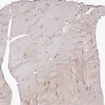 TMIE Antibody in Immunohistochemistry (Paraffin) (IHC (P))