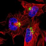 TMEM165 Polyclonal Antibody