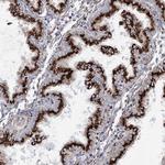 TMEM165 Antibody in Immunohistochemistry (Paraffin) (IHC (P))