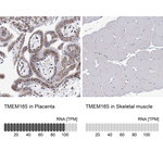 TMEM165 Antibody in Immunohistochemistry (Paraffin) (IHC (P))