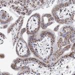 TMEM165 Antibody in Immunohistochemistry (Paraffin) (IHC (P))