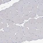 TMEM165 Antibody in Immunohistochemistry (Paraffin) (IHC (P))