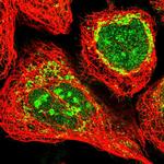 ECHDC3 Polyclonal Antibody