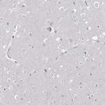ECHDC3 Antibody in Immunohistochemistry (Paraffin) (IHC (P))