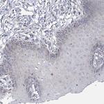ECHDC3 Antibody in Immunohistochemistry (Paraffin) (IHC (P))