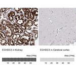 ECHDC3 Antibody in Immunohistochemistry (IHC)