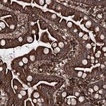 FGFR1OP2 Polyclonal Antibody