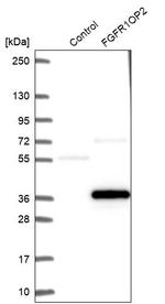 FGFR1OP2 Antibody in Western Blot (WB)