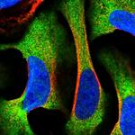 RPAP3 Polyclonal Antibody