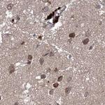 RPAP3 Antibody in Immunohistochemistry (IHC)